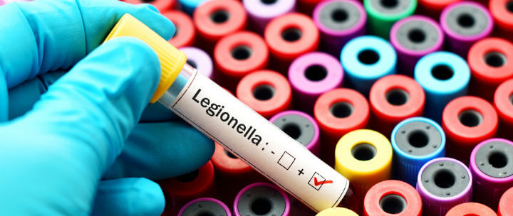 legionella water testing